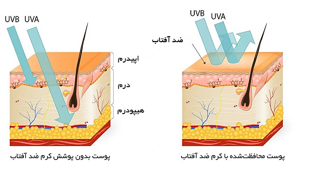نقش ضدآفتاب در مقابل پرتو فرابنفش